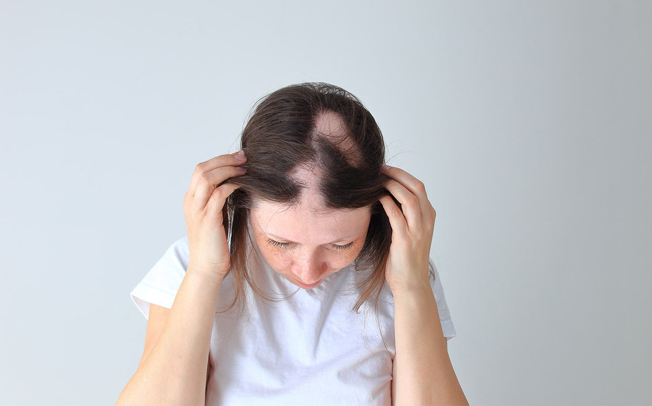 Wigs for Alopecia: Tips on Finding Wigs and Styling Them